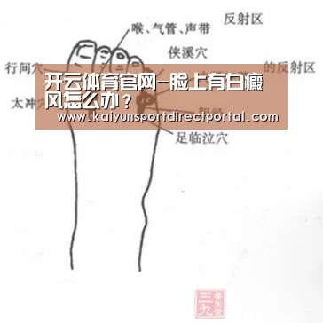 开云体育官网-脸上有白癜风怎么办?(图1) 开云体育官网
